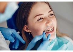 השתלת שיניים באשדוד